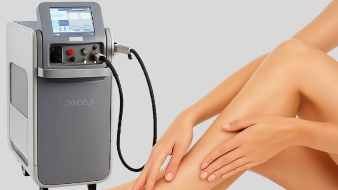 Συνεδρία Αποτρίχωσης Laser Alexandrite Candela Pro U – Για Γυναίκες & Άνδρες